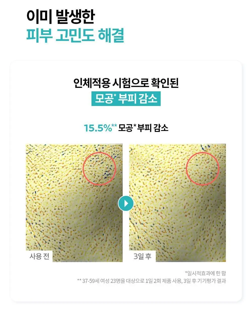 [피지각질케어] 라로슈포제 에빠끌라 듀오+ M 트러블 에센스 40ml 기획(+에빠끌라 폼 50ml) 상세페이지 7